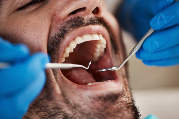 Best Emergency Dental Services for Seniors in West Fairview, PA
